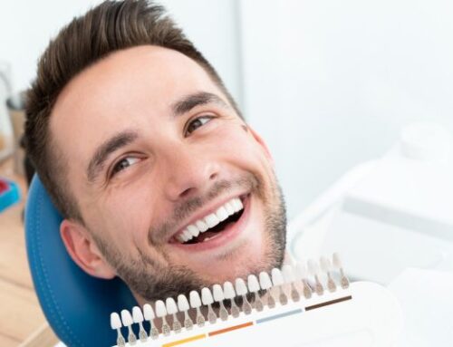 Las ventajas de las carillas dentales para una sonrisa más brillante y natural