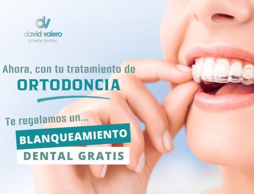 Aprovecha esta Promoción Única: Ortodoncia+ Blanqueamiento Dental Gratis